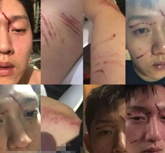 八面修罗之凤凰雪